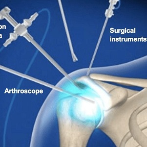 arthroscopy surgery center