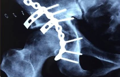 trauma services patna